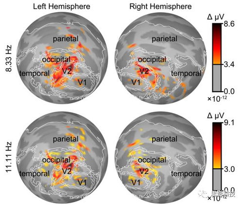 腦磁圖（MEG）數(shù)據(jù)處理 思影數(shù)據(jù)處理服務(wù)六的專業(yè)解決方案